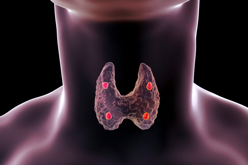 The Connection Between Stress and Thyroid